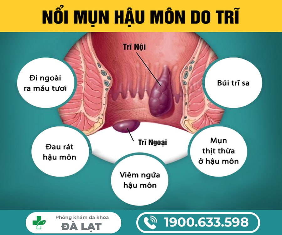 Hình ảnh minh họa